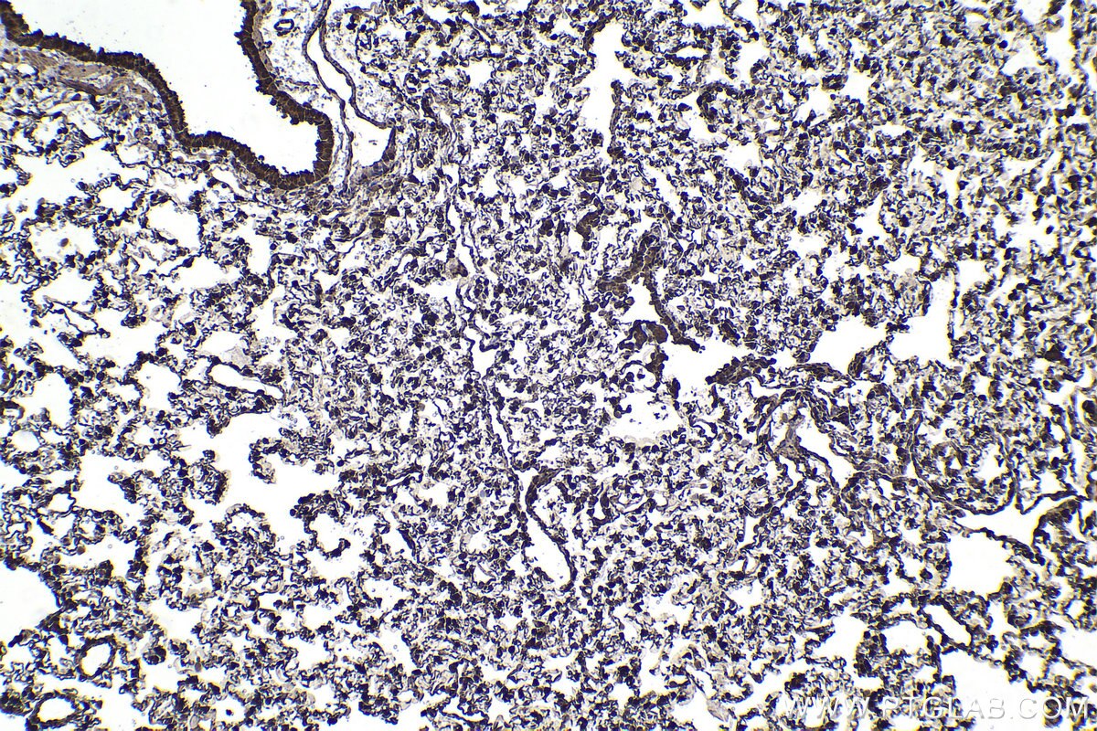 Immunohistochemical analysis of paraffin-embedded rat lung tissue slide using KHC2243 (HSPA1L IHC Kit).