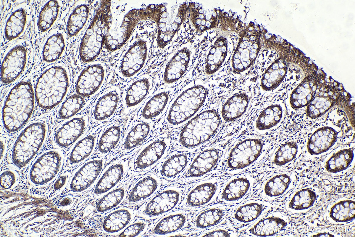 Immunohistochemical analysis of paraffin-embedded human colon tissue slide using KHC1134 (HSPA6 IHC Kit).