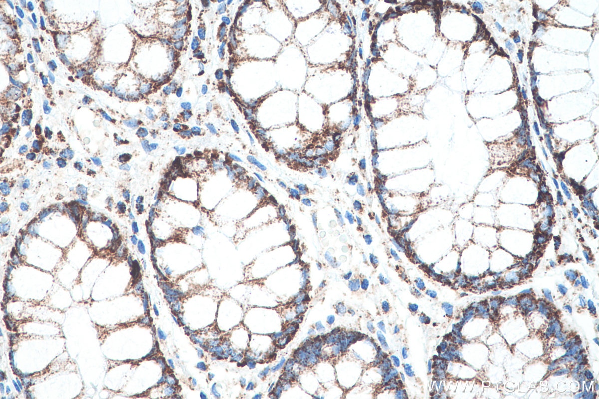 Immunohistochemical analysis of paraffin-embedded human colon tissue slide using KHC0540 (HSPA9/GRP75 IHC Kit).