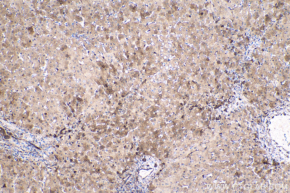 Immunohistochemical analysis of paraffin-embedded human liver tissue slide using KHC0427 (HSPB1 IHC Kit).