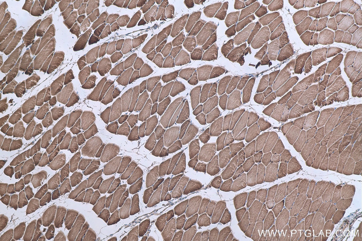 Immunohistochemical analysis of paraffin-embedded mouse skeletal muscle tissue slide using KHC0668 (HSPB6 IHC Kit).