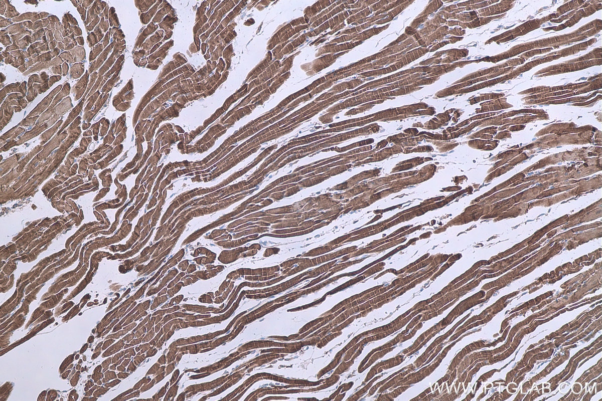 Immunohistochemical analysis of paraffin-embedded mouse heart tissue slide using KHC0668 (HSPB6 IHC Kit).