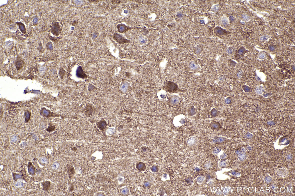 Immunohistochemical analysis of paraffin-embedded mouse brain tissue slide using KHC2340 (HSP10 IHC Kit).
