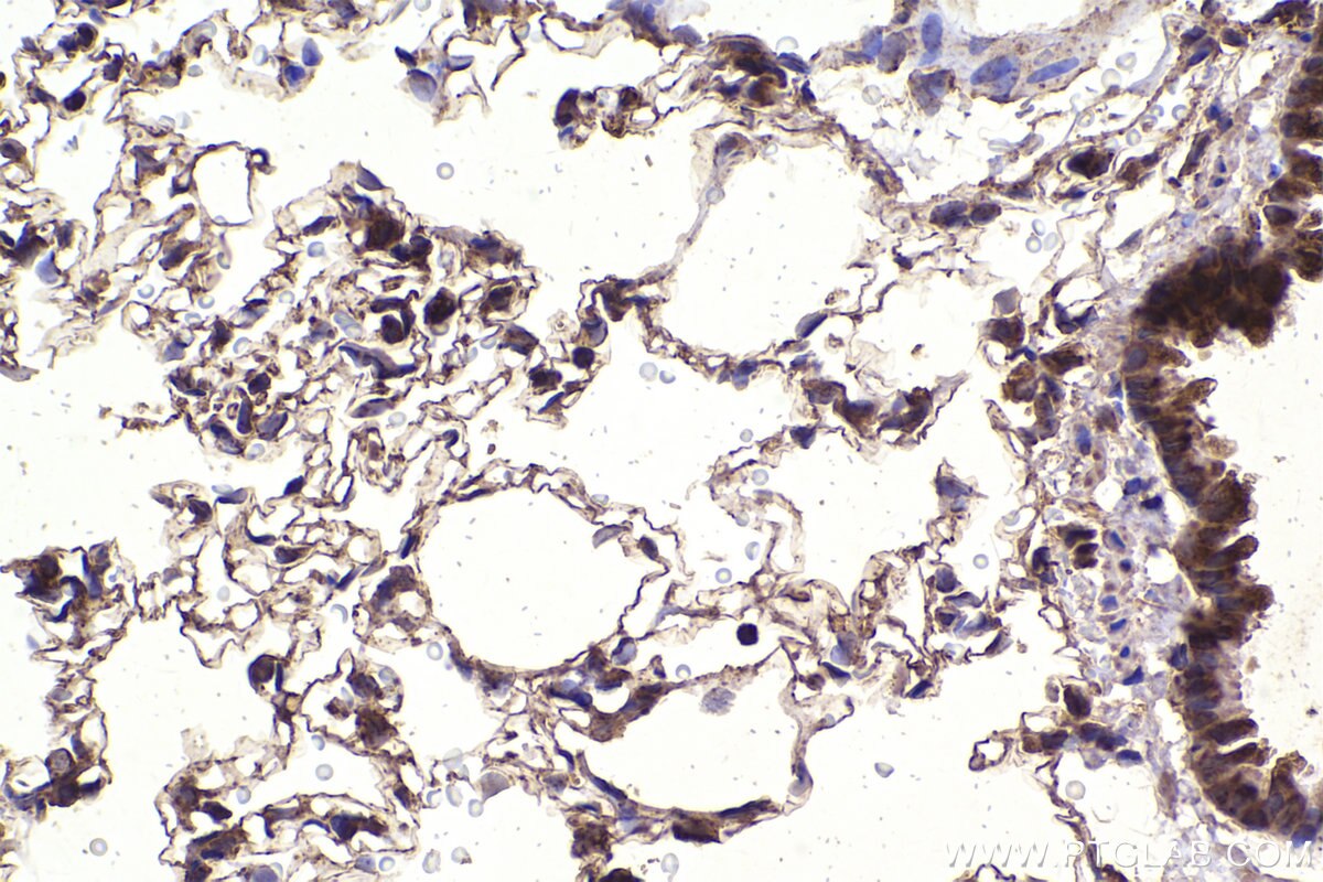 Immunohistochemical analysis of paraffin-embedded rat lung tissue slide using KHC2340 (HSP10 IHC Kit).