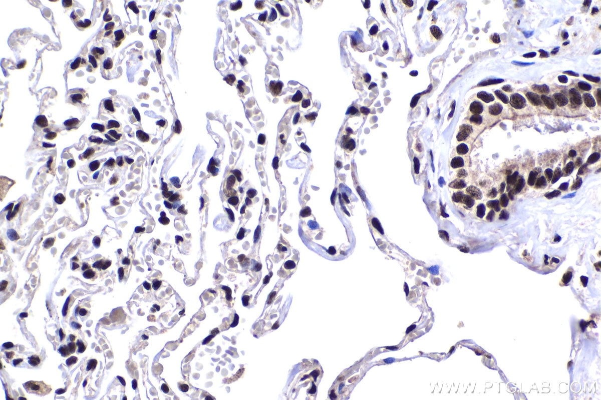 Immunohistochemical analysis of paraffin-embedded human lung tissue slide using KHC1456 (HTATSF1 IHC Kit).