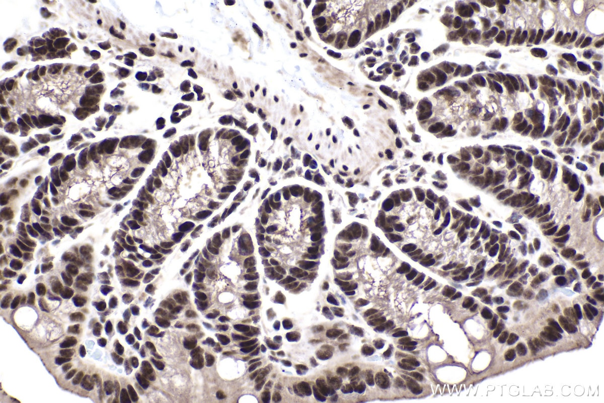 Immunohistochemical analysis of paraffin-embedded mouse colon tissue slide using KHC1456 (HTATSF1 IHC Kit).