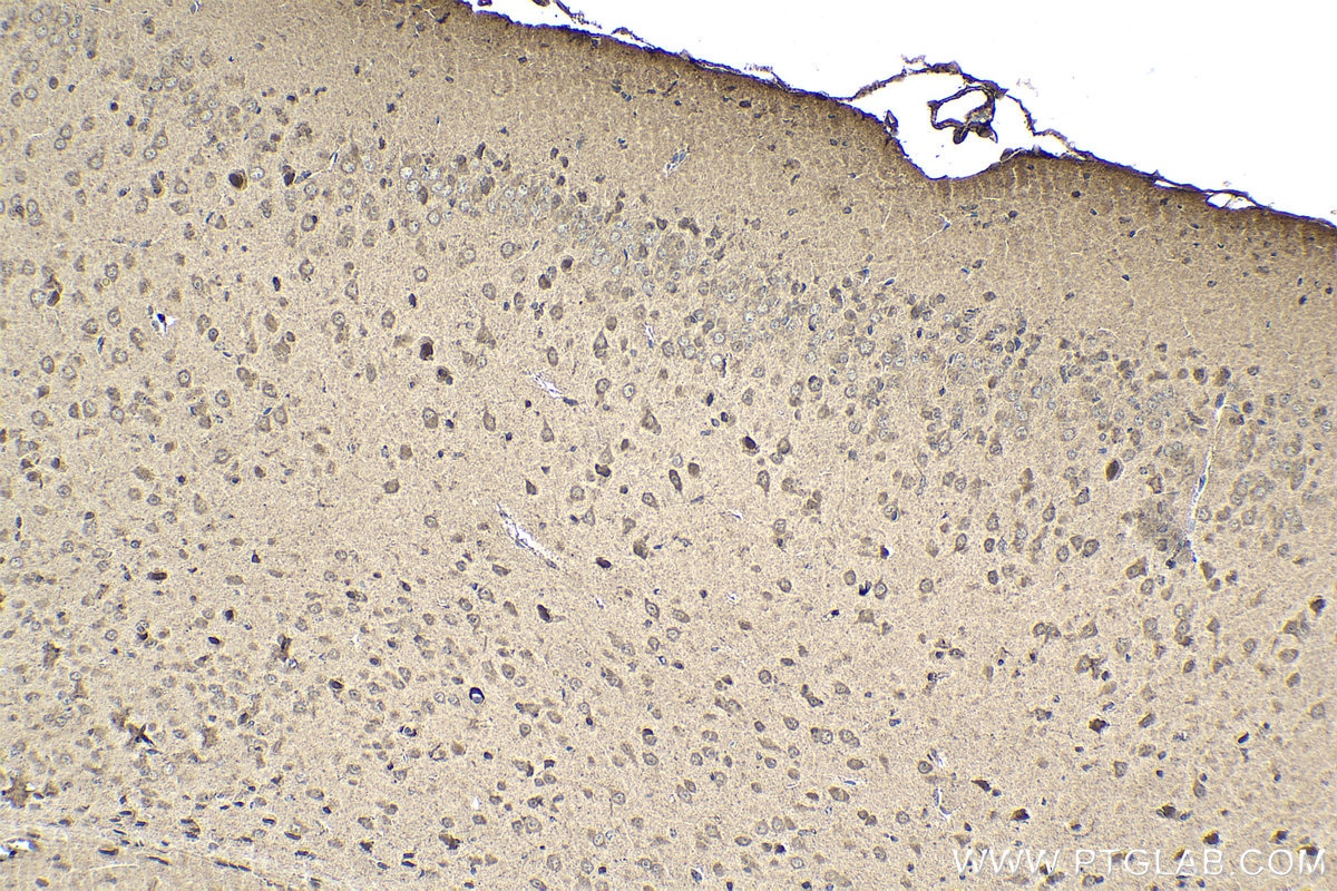 Immunohistochemical analysis of paraffin-embedded mouse brain tissue slide using KHC1597 (HTT IHC Kit).