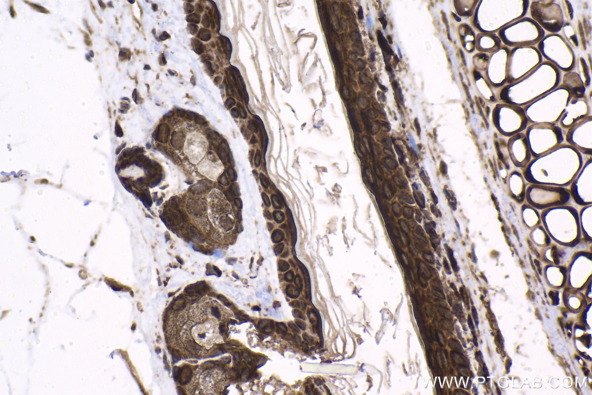 Immunohistochemical analysis of paraffin-embedded mouse skin tissue slide using KHC1597 (HTT IHC Kit).