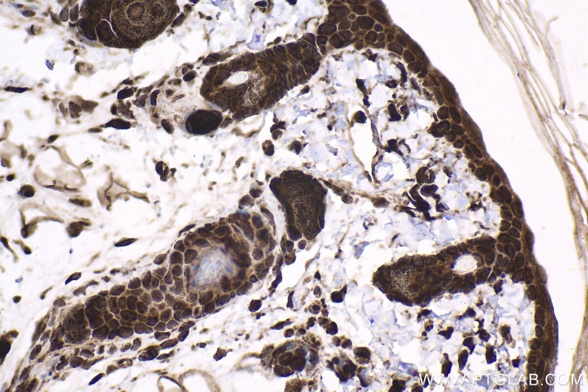 Immunohistochemical analysis of paraffin-embedded rat skin tissue slide using KHC1597 (HTT IHC Kit).