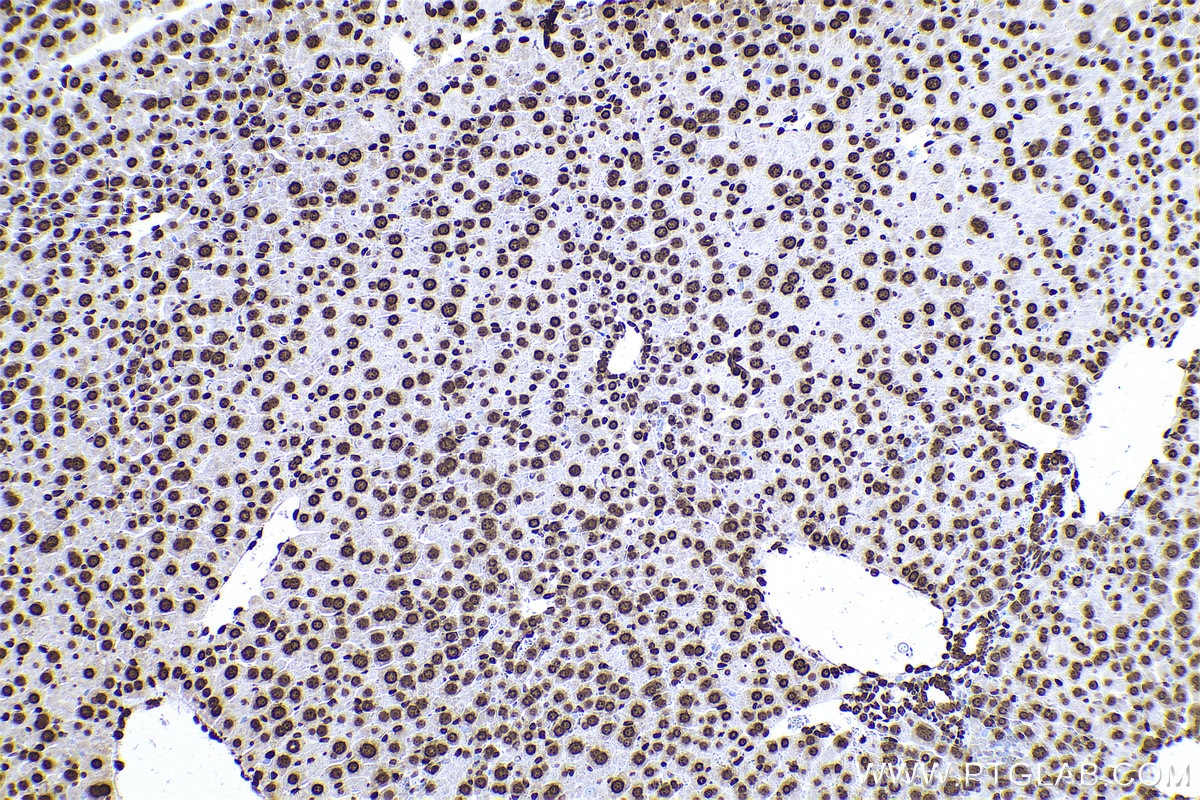 Immunohistochemical analysis of paraffin-embedded mouse liver tissue slide using KHC0594 (Histone H1.0 IHC Kit).