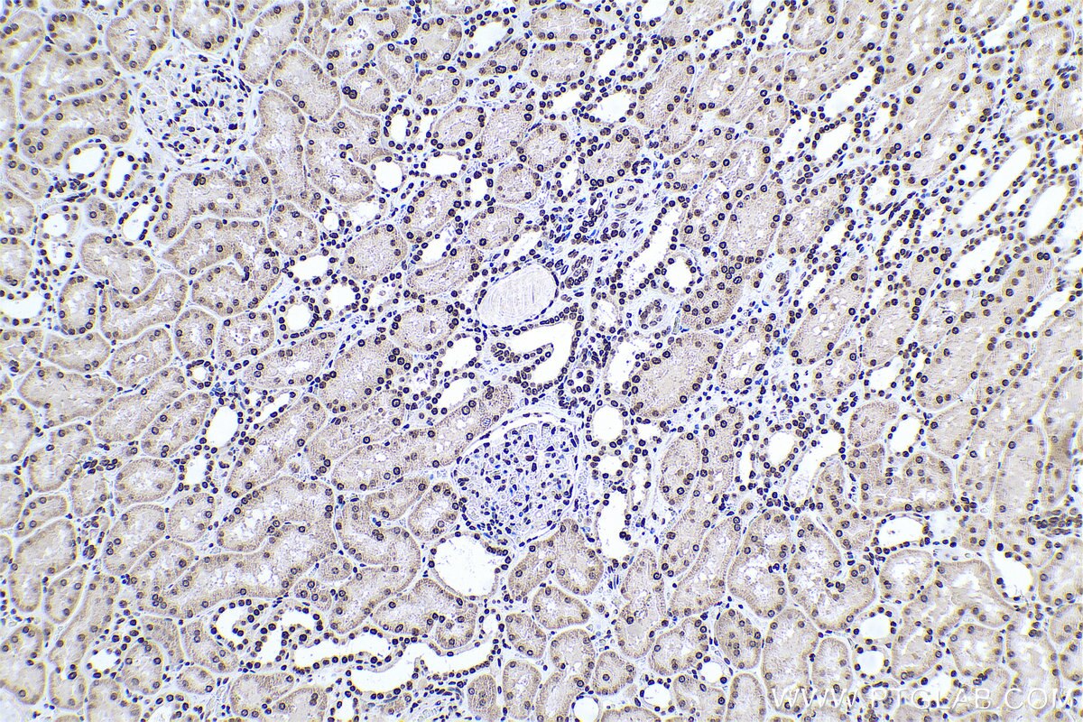 Immunohistochemical analysis of paraffin-embedded human kidney tissue slide using KHC0594 (Histone H1.0 IHC Kit).