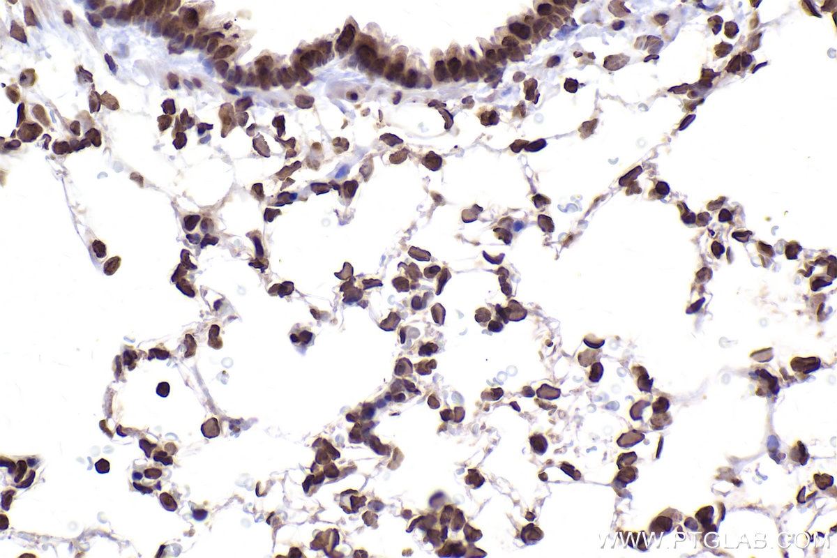 Immunohistochemical analysis of paraffin-embedded rat lung tissue slide using KHC2506 (Histone H3.4 IHC Kit).