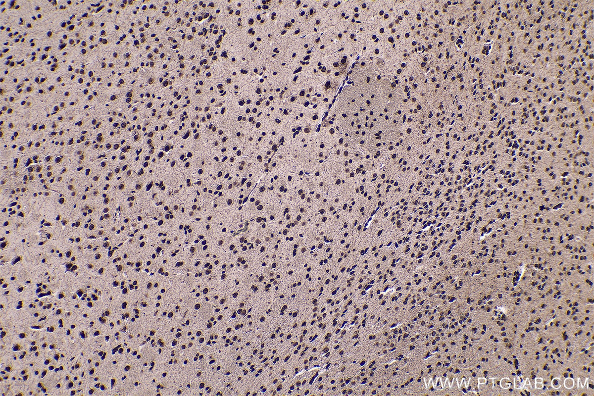 Immunohistochemical analysis of paraffin-embedded mouse brain tissue slide using KHC0568 (Histone-H3 IHC Kit).