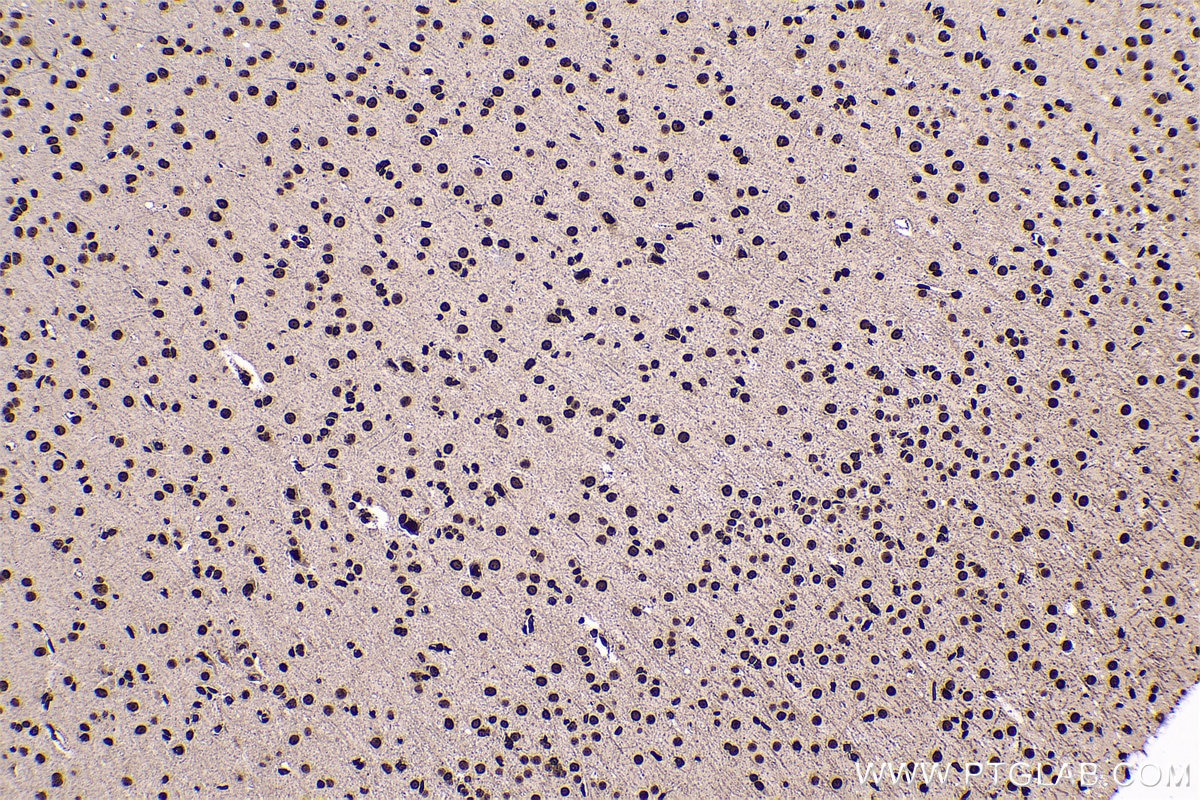 Immunohistochemical analysis of paraffin-embedded rat brain tissue slide using KHC0568 (Histone-H3 IHC Kit).