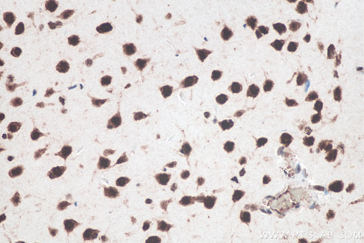 Immunohistochemical analysis of paraffin-embedded rat brain tissue slide using KHC0049 (HuR IHC Kit).