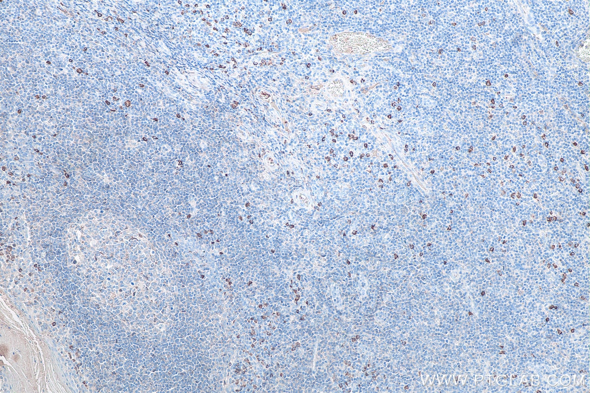 Immunohistochemical analysis of paraffin-embedded human tonsillitis tissue slide using KHC0070 (Human IgA IHC Kit).