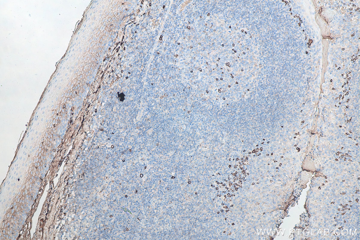 Immunohistochemical analysis of paraffin-embedded human tonsillitis tissue slide using KHC0073 (Human IgG lambda chain IHC Kit).