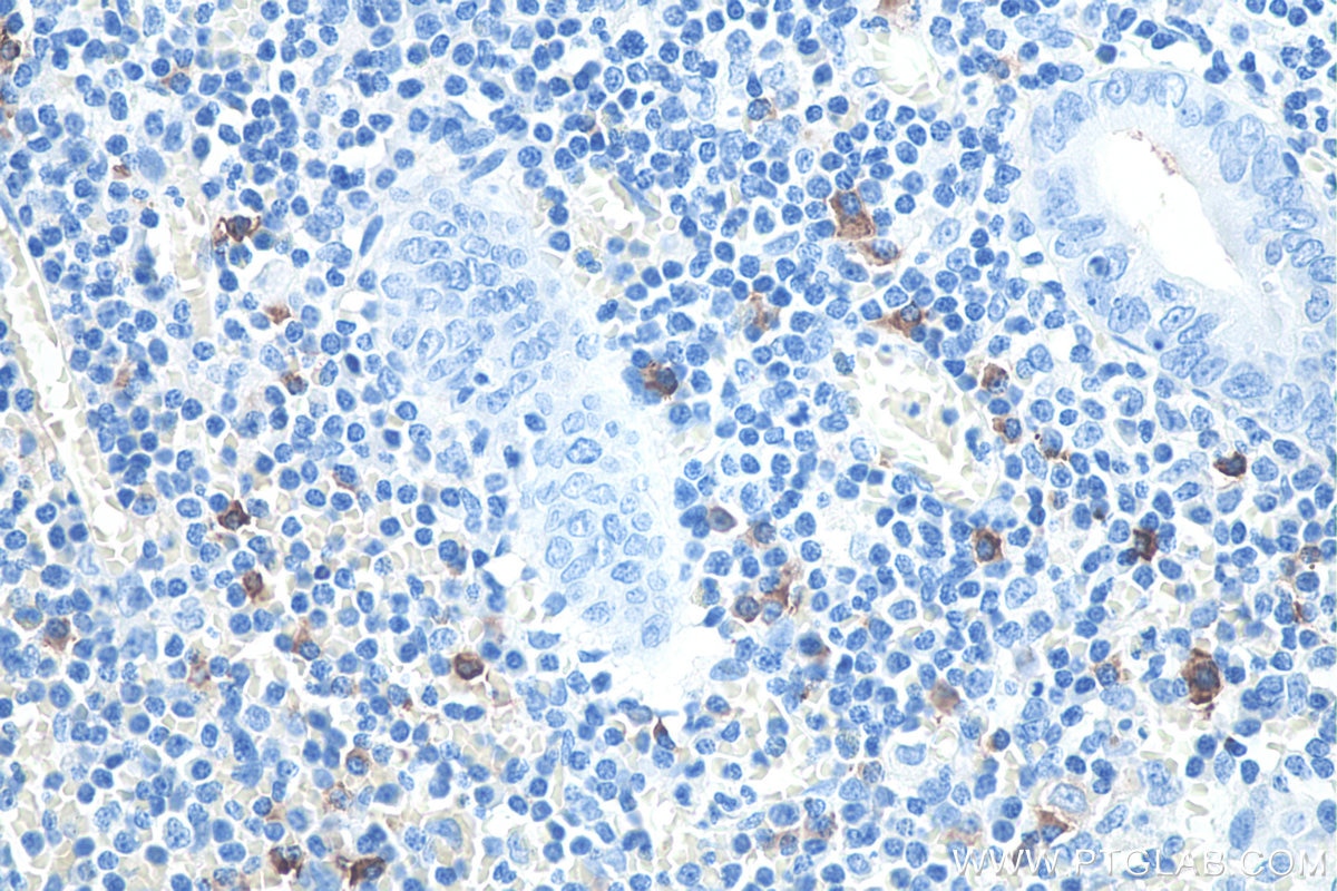 Immunohistochemical analysis of paraffin-embedded human appendicitis tissue slide using KHC0074 (Human IgG4 IHC Kit).