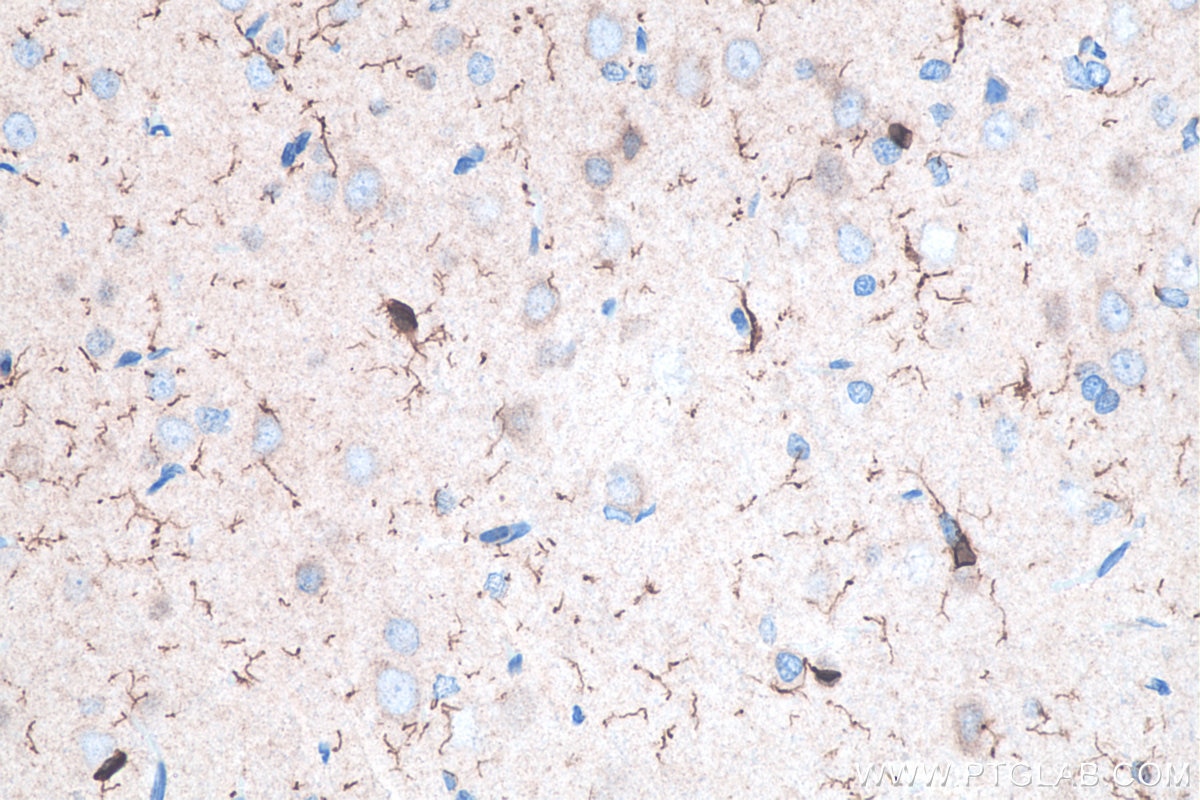 Immunohistochemical analysis of paraffin-embedded rat brain tissue slide using KHC0056 (IBA1 IHC Kit).