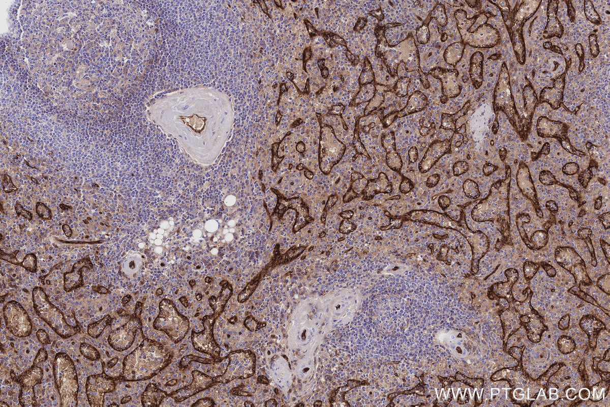 Immunohistochemical analysis of paraffin-embedded human spleen tissue slide using KHC3132 (ICAM2/CD102 IHC Kit). Immunohistochemical analysis of paraffin-embedded human spleen tissue slide using KHC3132 (ICAM2/CD102 IHC Kit).