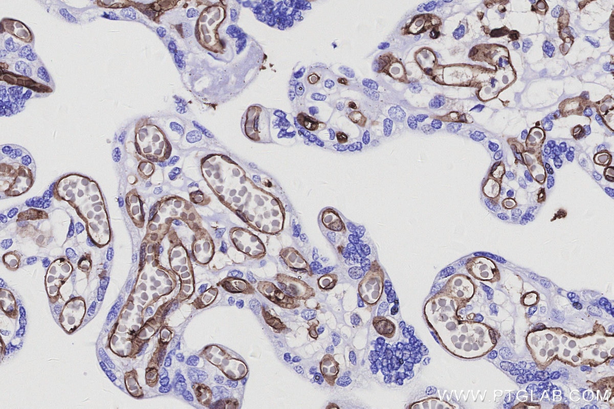 Immunohistochemical analysis of paraffin-embedded human placenta tissue slide using KHC3132 (ICAM2/CD102 IHC Kit). Immunohistochemical analysis of paraffin-embedded human placenta tissue slide using KHC3132 (ICAM2/CD102 IHC Kit).