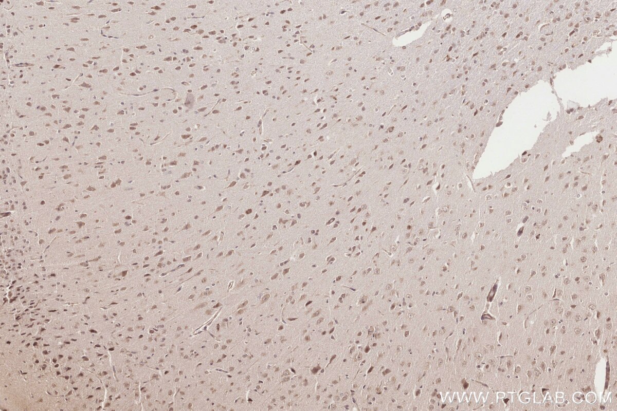 Immunohistochemical analysis of paraffin-embedded rat brain tissue slide using KHC3252 (ICT1 IHC Kit).