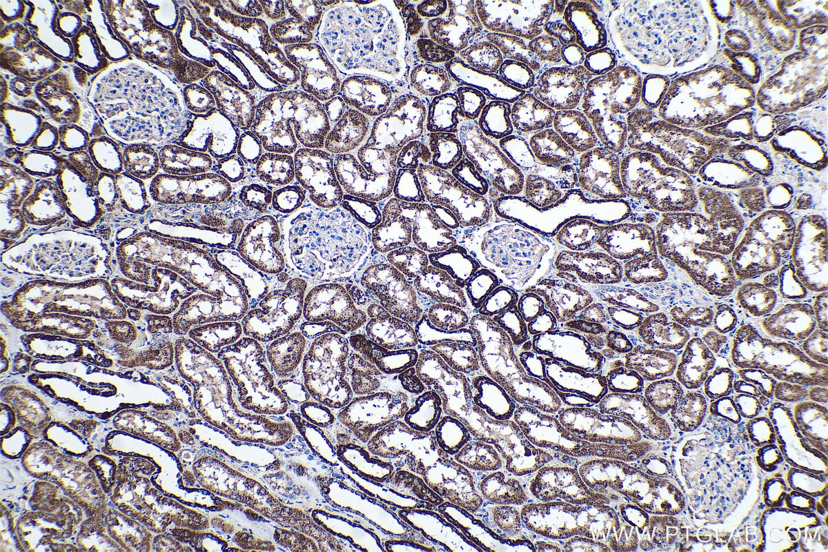 Immunohistochemical analysis of paraffin-embedded human kidney tissue slide using KHC0580 (IDH2 IHC Kit).