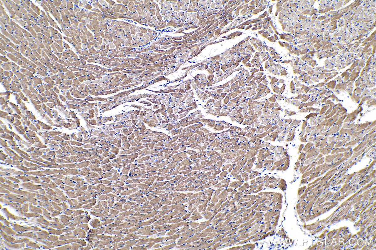 Immunohistochemical analysis of paraffin-embedded rat heart tissue slide using KHC0580 (IDH2 IHC Kit).