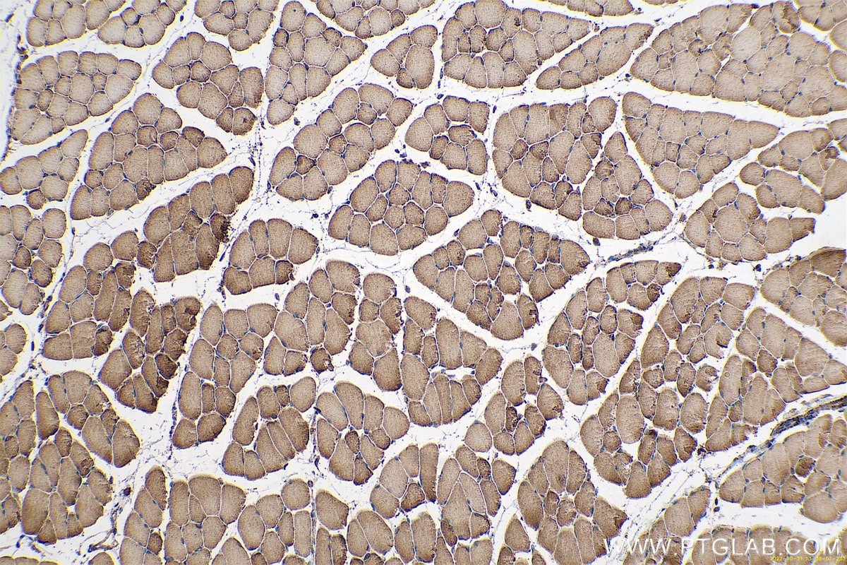 Immunohistochemical analysis of paraffin-embedded mouse skeletal muscle tissue slide using KHC0580 (IDH2 IHC Kit).