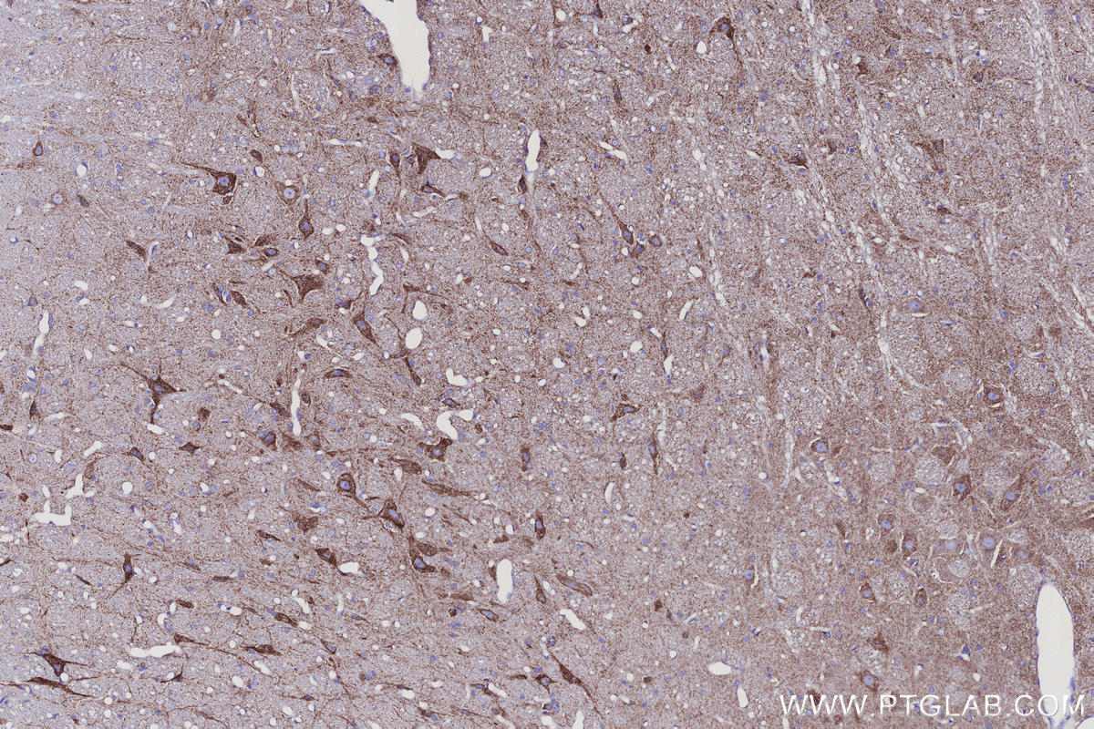 Immunohistochemical analysis of paraffin-embedded rat cerebellum tissue slide using KHC3145 (IDH3B IHC Kit).