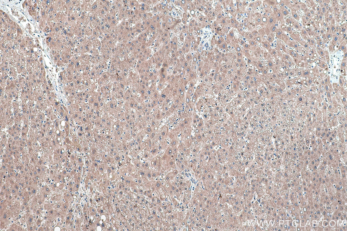 Immunohistochemical analysis of paraffin-embedded human liver tissue slide using KHC0428 (IDI1 IHC Kit).