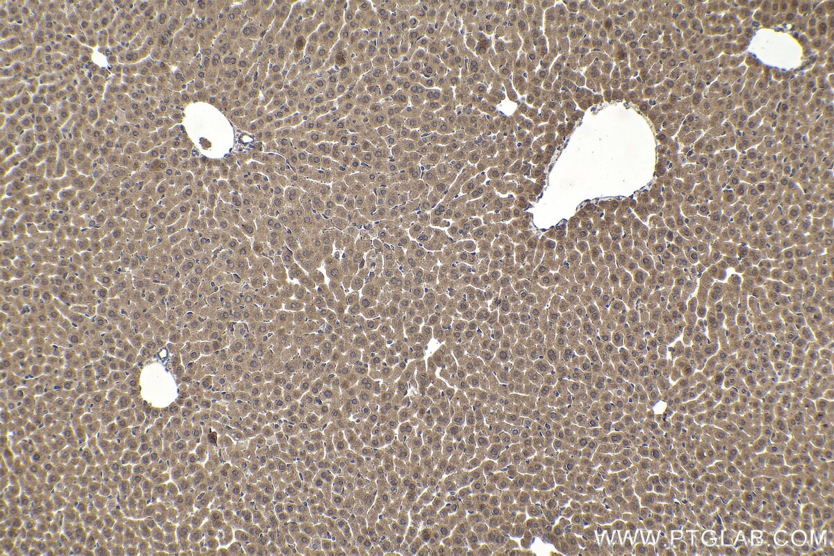 Immunohistochemical analysis of paraffin-embedded mouse liver tissue slide using KHC1904 (IER2 IHC Kit).