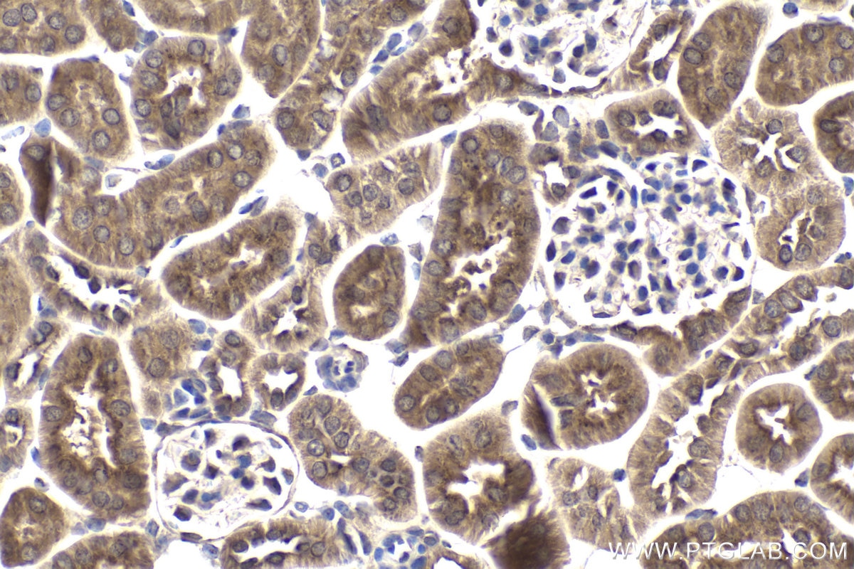 Immunohistochemical analysis of paraffin-embedded mouse kidney tissue slide using KHC1904 (IER2 IHC Kit).