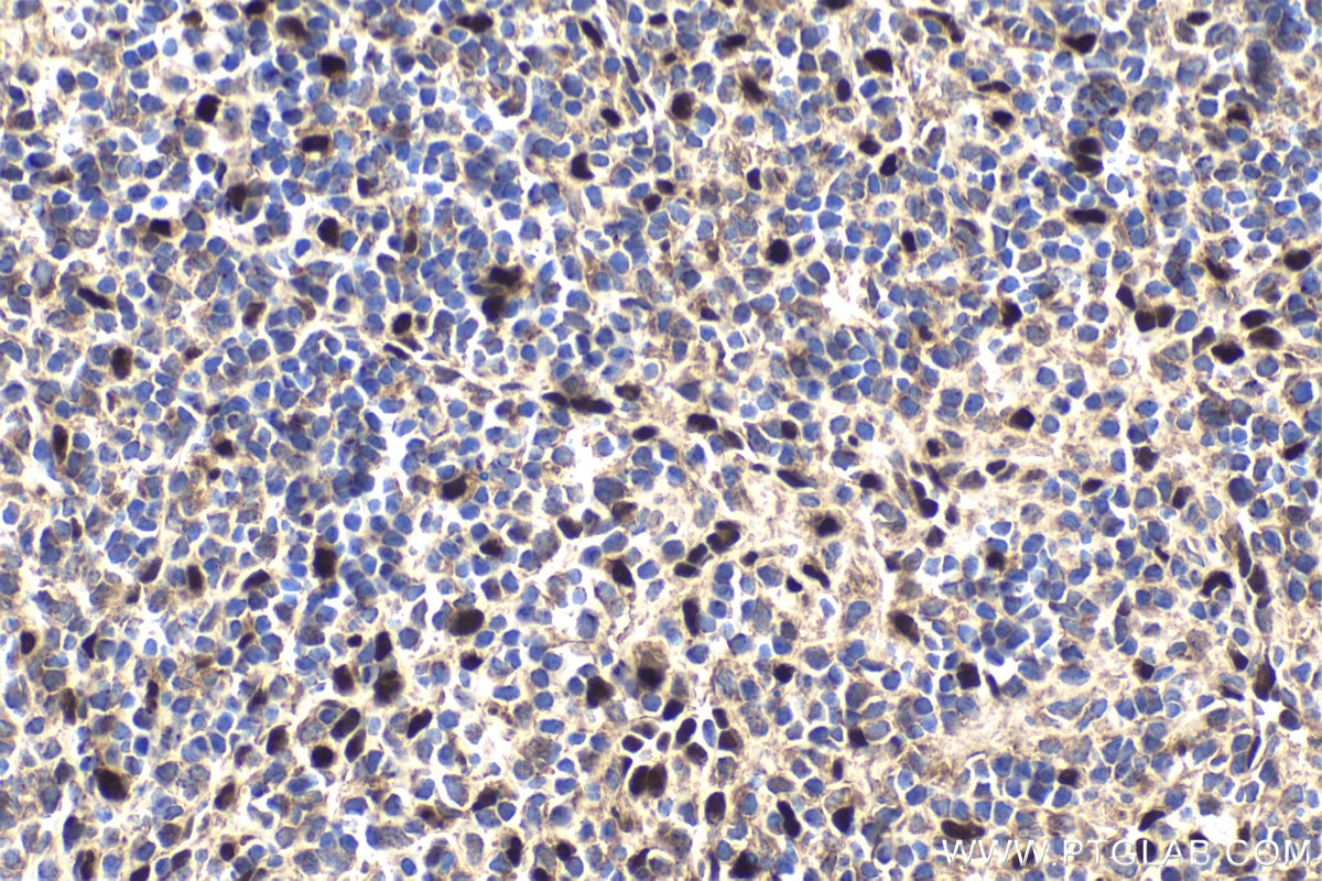 Immunohistochemical analysis of paraffin-embedded mouse spleen tissue slide using KHC1764 (IFI16 IHC Kit).