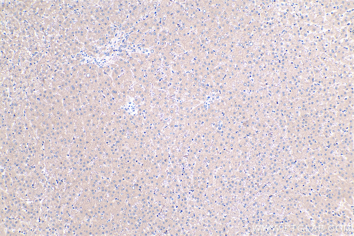 Immunohistochemical analysis of paraffin-embedded human liver tissue slide using KHC0430 (IFI6/G1P3 IHC Kit).