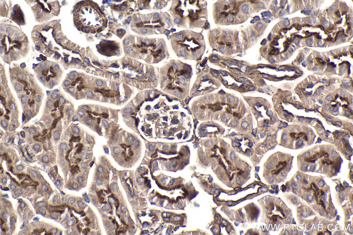 Immunohistochemical analysis of paraffin-embedded mouse kidney tissue slide using KHC1910 (IFIH1 IHC Kit).