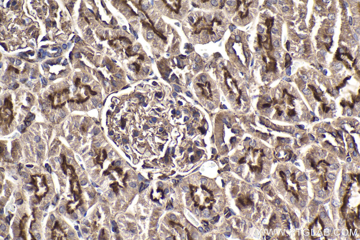 Immunohistochemical analysis of paraffin-embedded rat kidney tissue slide using KHC1910 (IFIH1 IHC Kit).