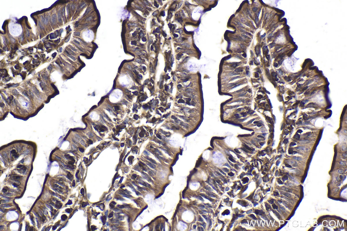 Immunohistochemical analysis of paraffin-embedded rat small intestine tissue slide using KHC1910 (IFIH1 IHC Kit).