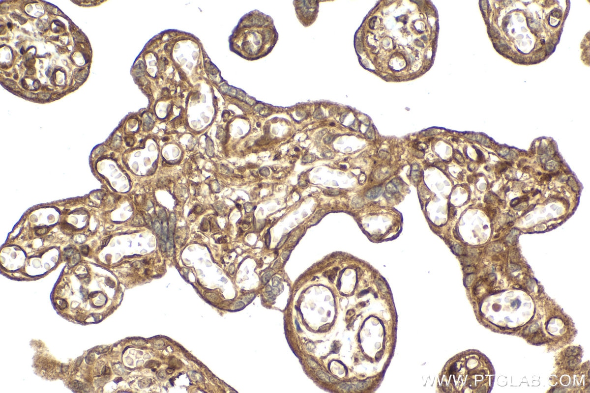 Immunohistochemical analysis of paraffin-embedded human placenta tissue slide using KHC2059 (IFIT3 IHC Kit).