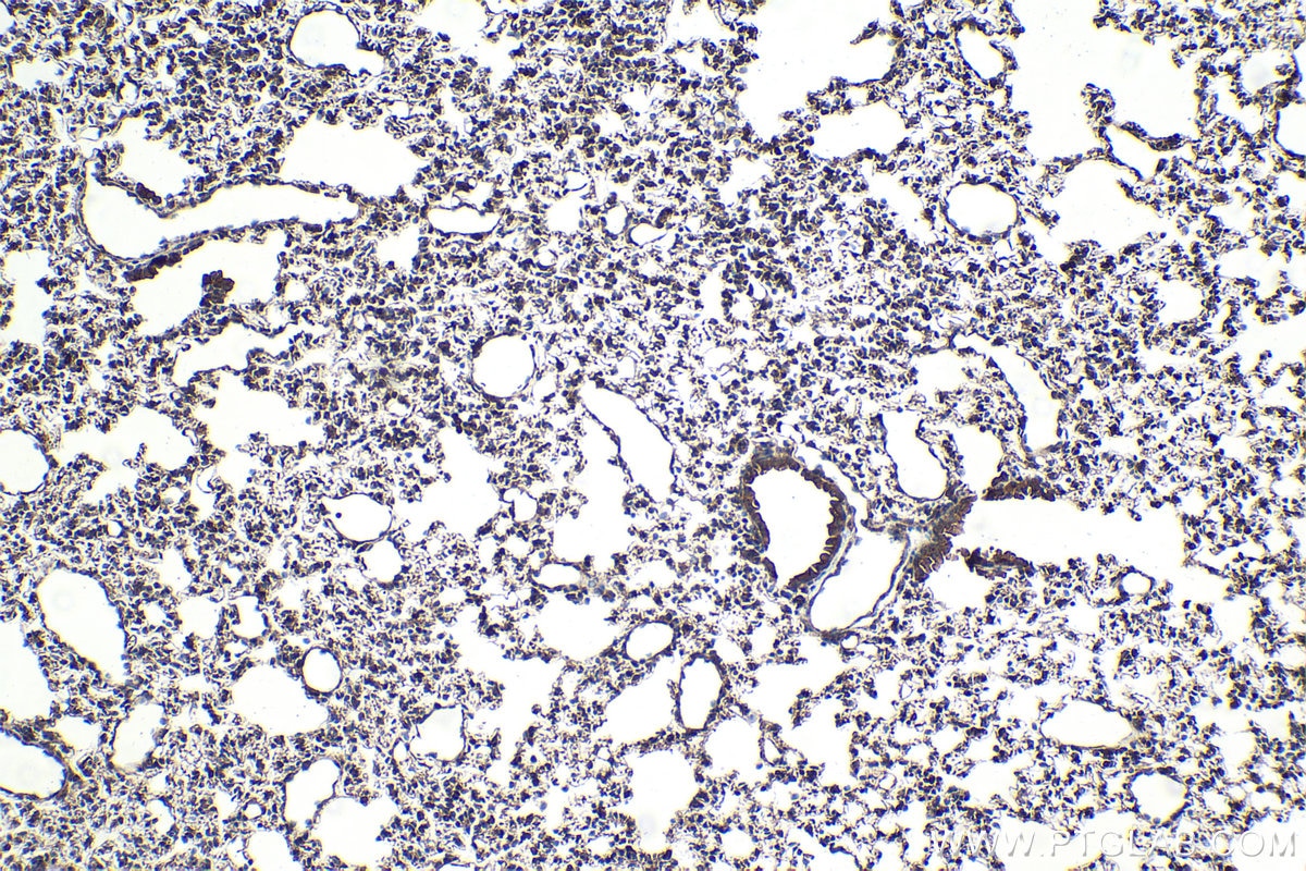 Immunohistochemical analysis of paraffin-embedded mouse lung tissue slide using KHC2059 (IFIT3 IHC Kit).