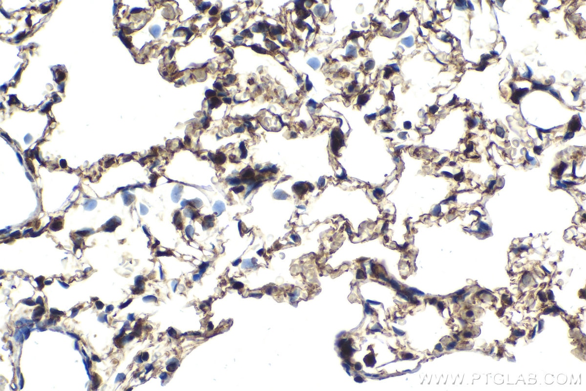 Immunohistochemical analysis of paraffin-embedded rat lung tissue slide using KHC2059 (IFIT3 IHC Kit).