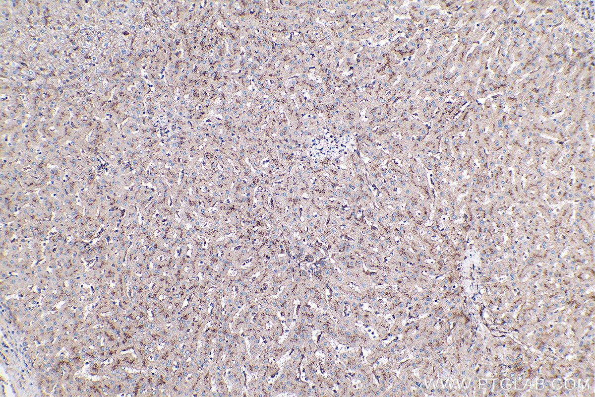 Immunohistochemical analysis of paraffin-embedded human liver tissue slide using KHC0431 (IFITM2/3 IHC Kit).