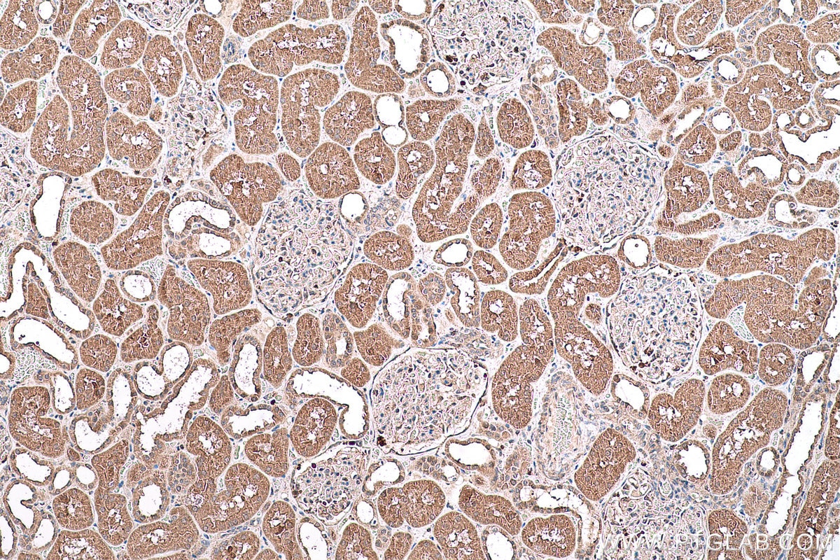 Immunohistochemical analysis of paraffin-embedded human kidney tissue slide using KHC0737 (IGF1R IHC Kit).