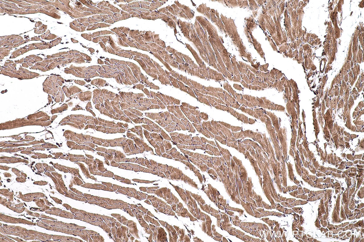 Immunohistochemical analysis of paraffin-embedded mouse heart tissue slide using KHC0737 (IGF1R IHC Kit).