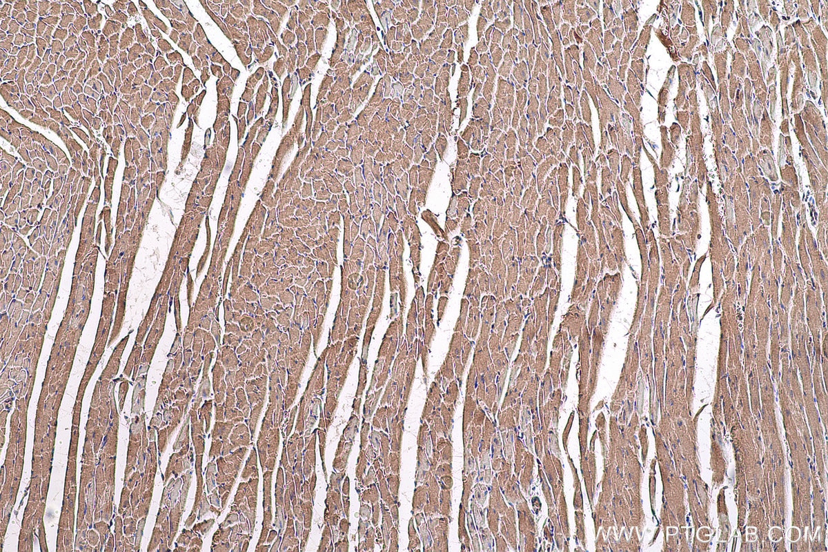 Immunohistochemical analysis of paraffin-embedded rat heart tissue slide using KHC0737 (IGF1R IHC Kit).