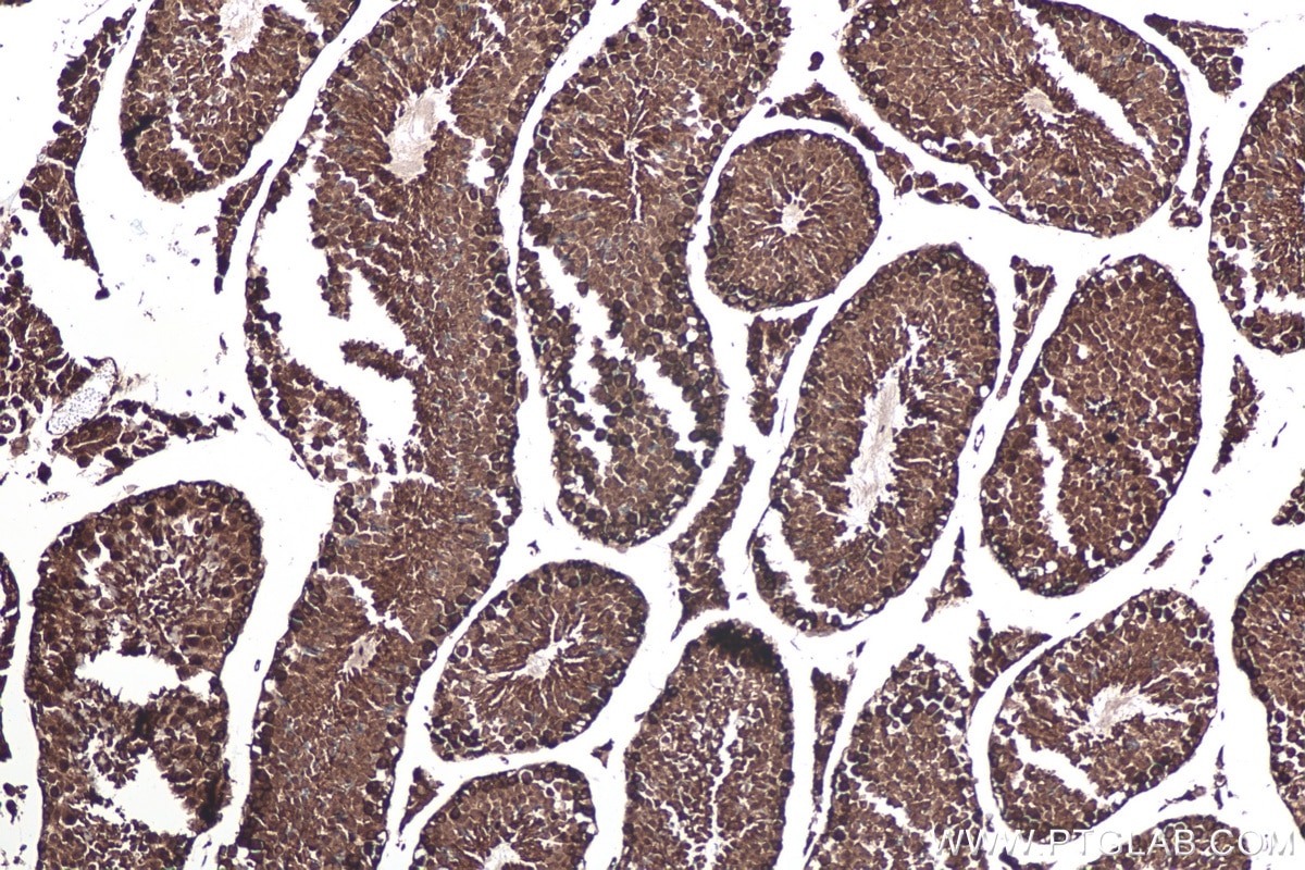 Immunohistochemical analysis of paraffin-embedded mouse testis tissue slide using KHC0160 (IGF2BP1 IHC Kit).