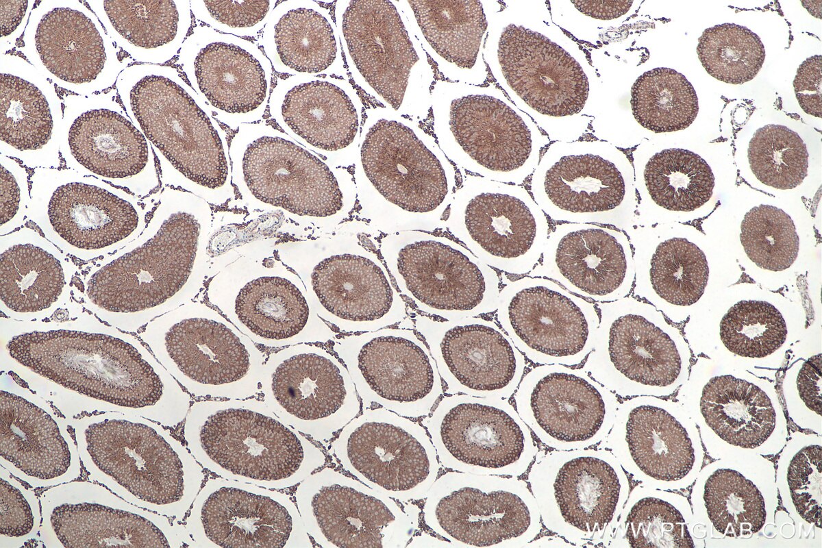 Immunohistochemical analysis of paraffin-embedded rat testis tissue slide using KHC0160 (IGF2BP1 IHC Kit).