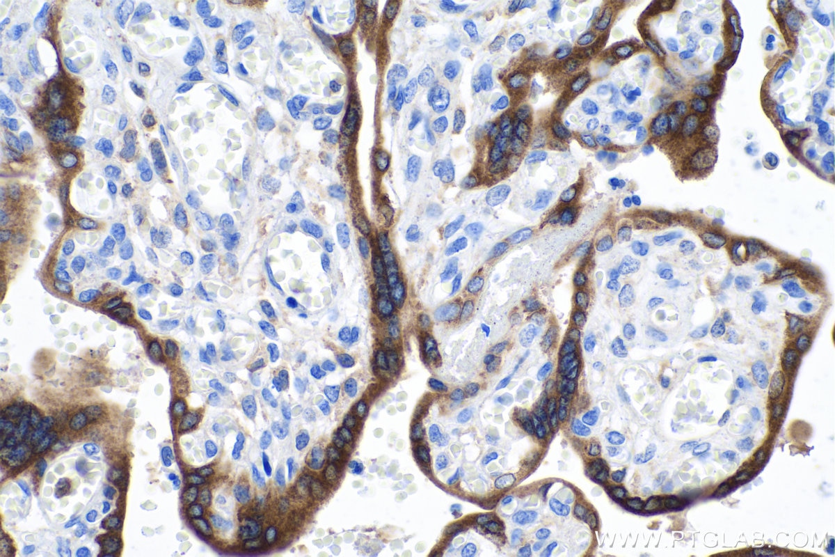 Immunohistochemical analysis of paraffin-embedded human placenta tissue slide using KHC0162 (IGF2BP3 IHC Kit).