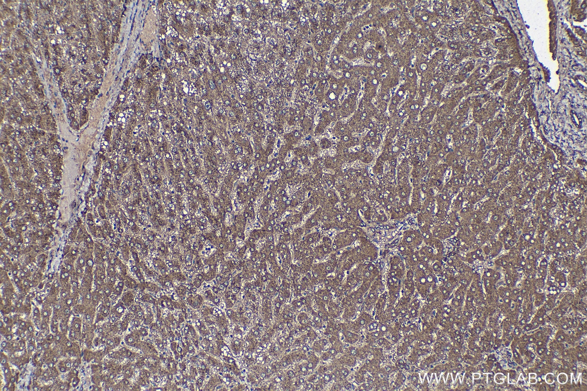 Immunohistochemical analysis of paraffin-embedded human liver tissue slide using KHC1361 (IGF2R-Specific IHC Kit).