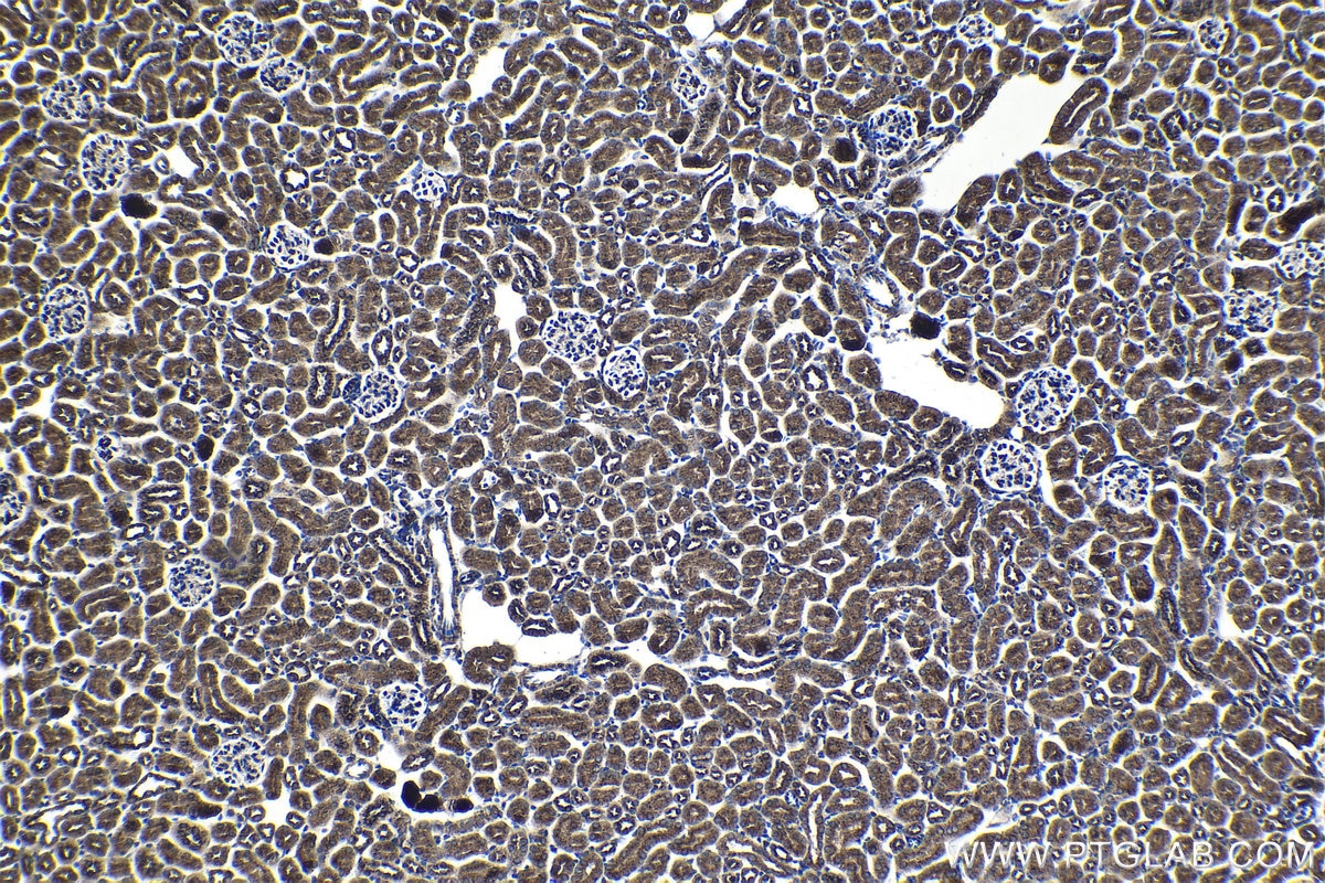 Immunohistochemical analysis of paraffin-embedded mouse kidney tissue slide using KHC1361 (IGF2R-Specific IHC Kit).